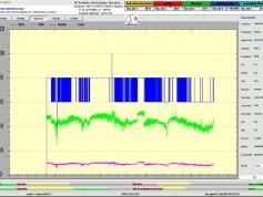 dxsatcs-express-am7-40e-sat-reception-prodelin-450cm-KU-Fixed-beam-Russia-11070-V-NNTV-77h-signal-monitoring-B01