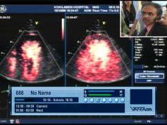 Insat 3A at 93.5 e _ feeds 4 053 V feeds from Kokilaben Hospital India  01